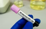 Fièvre de la Vallée du Rift et Mpox : Après Dakar, une autre région impactée