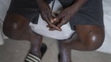 Attention : « Le virus du Mpox circule à Dakar… » (Directeur de la prévention)